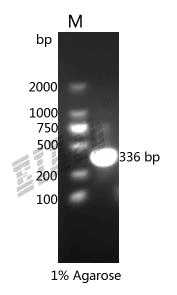 Human LBP Protein