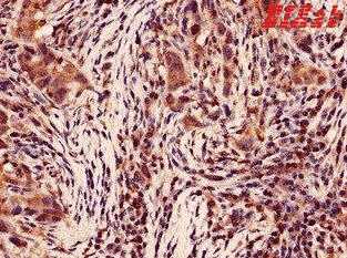 Human CASP4 Polyclonal Antibody