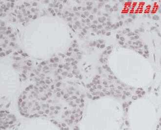 Human CCL11 Polyclonal Antibody