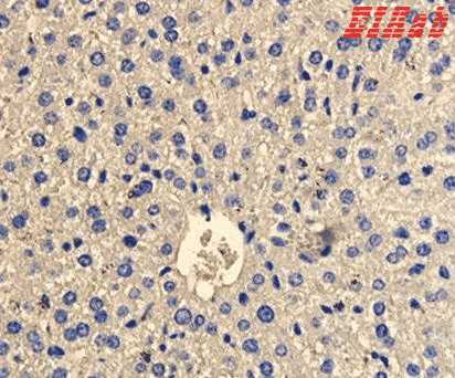 Human CD163 Polyclonal Antibody