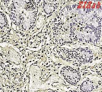 Human CD177 Polyclonal Antibody