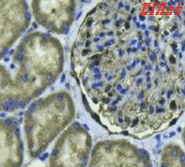 Human CD3E Polyclonal Antibody