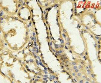 Human CD40LG Polyclonal Antibody