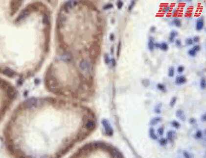 Human CLEC3B Polyclonal Antibody