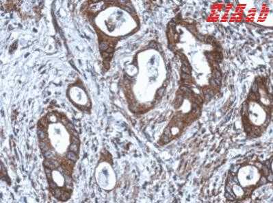 Human CNDP1 Polyclonal Antibody