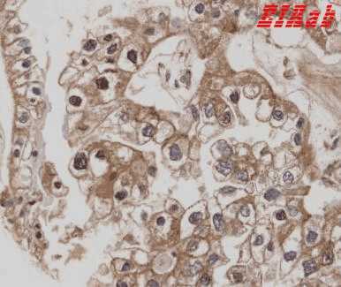 Human CNR1 Polyclonal Antibody