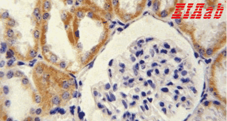 Human DEFB1 Polyclonal Antibody