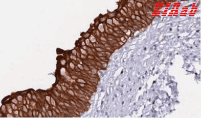 Human DENND2D Polyclonal Antibody