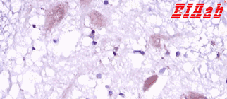 Human DKK3 Polyclonal Antibody