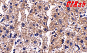 Human DRAM1 Polyclonal Antibody