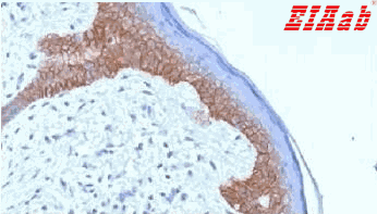 Human DSG3 Polyclonal Antibody
