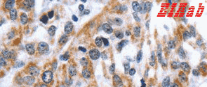 Human EDN3 Polyclonal Antibody