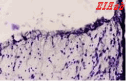 Human EDNRB Polyclonal Antibody