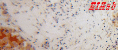Human EEF1A1 Polyclonal Antibody