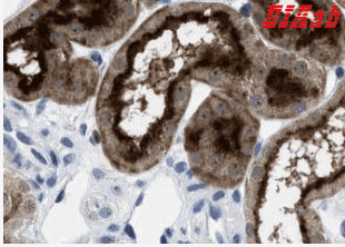 Human FAM151A Polyclonal Antibody