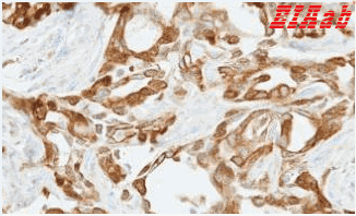 Human FBLN2 Polyclonal Antibody