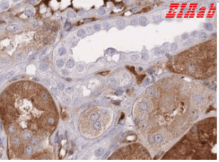 Human FBN3 Polyclonal Antibody