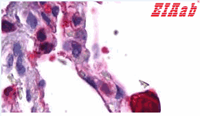 Human FCGR3A Polyclonal Antibody