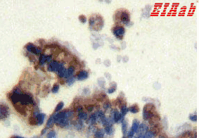 Human FCN3 Polyclonal Antibody