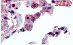 Human FFAR2 Polyclonal Antibody