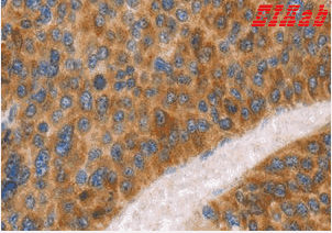 Human FGL1 Polyclonal Antibody
