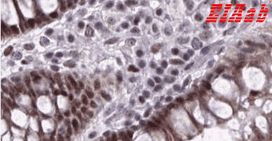 Human FIBCD1 Polyclonal Antibody