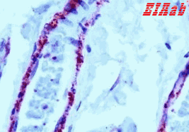 Human FLNC Polyclonal Antibody