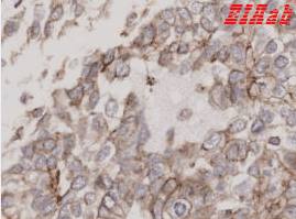 Human FLOT2 Polyclonal Antibody