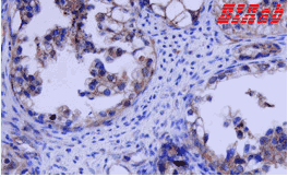 Human FLT1 Polyclonal Antibody