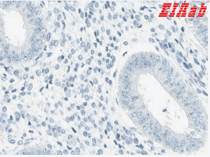 Human FMR1NB Polyclonal Antibody