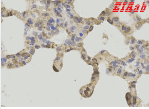 Human FTH1 Polyclonal Antibody