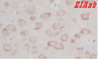 Human FZD3 Polyclonal Antibody