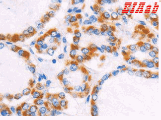 Human FZD4 Polyclonal Antibody