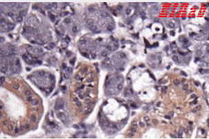 Human GAPDH Polyclonal Antibody