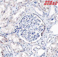 Human HAVCR1 Polyclonal Antibody