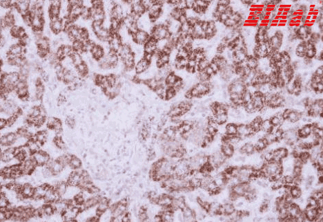 Human HIBADH Polyclonal Antibody