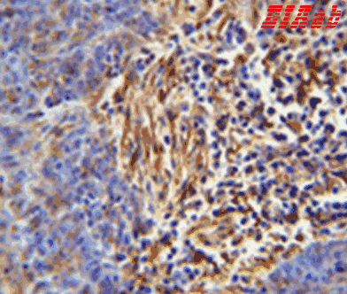 Human HLA-DRB5 Polyclonal Antibody