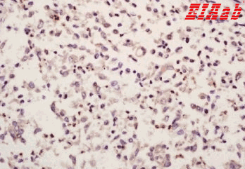 Human HMGB4 Polyclonal Antibody