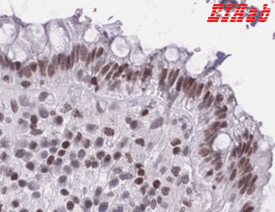 Human HMGN1 Polyclonal Antibody