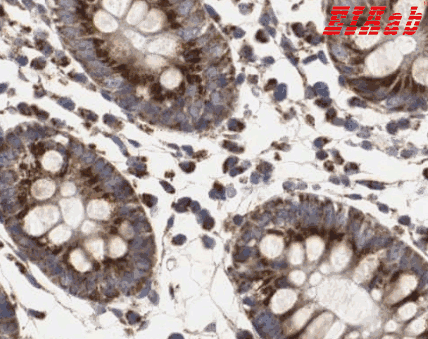 Human HSD17B10 Polyclonal Antibody