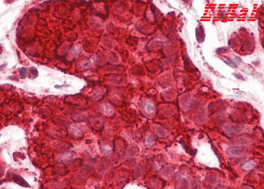 Human HSP90AA1 Polyclonal Antibody