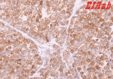 Human IFI30 Polyclonal Antibody