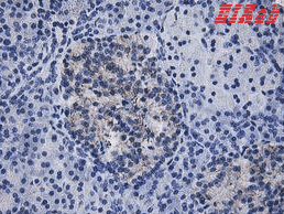 Human IFI35 Polyclonal Antibody