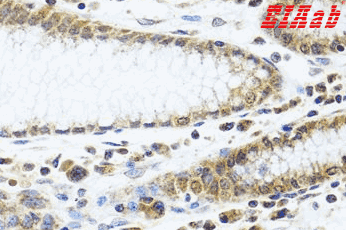 Human IFI44 Polyclonal Antibody