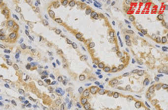 Human IFNB1 Polyclonal Antibody