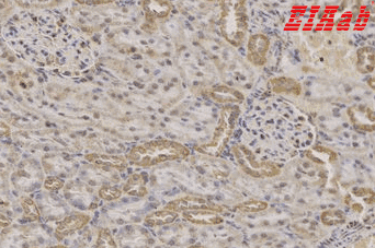 Human IGFBP5 Polyclonal Antibody