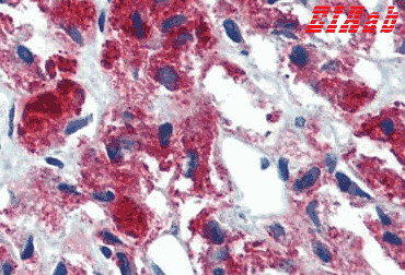 Human IL23A Polyclonal Antibody