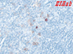 Human IL2RA Polyclonal Antibody