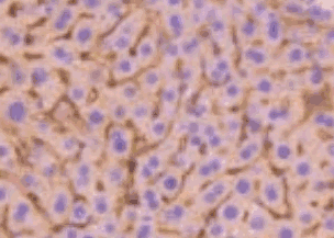 Human ADIPOR1 Monoclonal Antibody