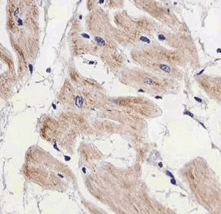Human AKT1S1 Monoclonal Antibody